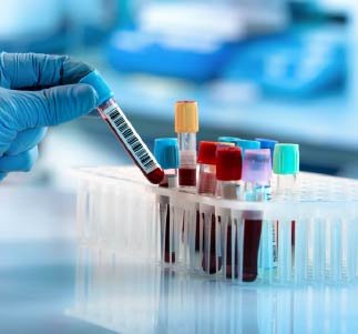 9. Laboratoire d’analyses à domicile